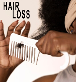 Hair Loss