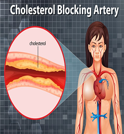 Cholesterol & Blood Fat