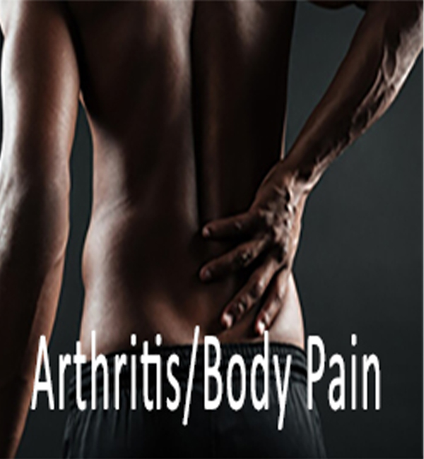 Arthritis