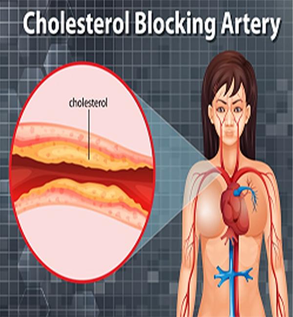 Cholesterol & Blood Fat