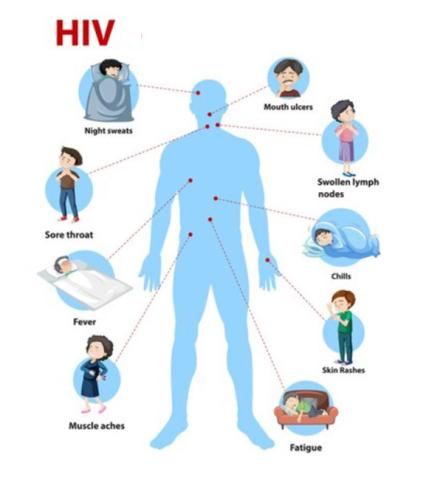 HIV