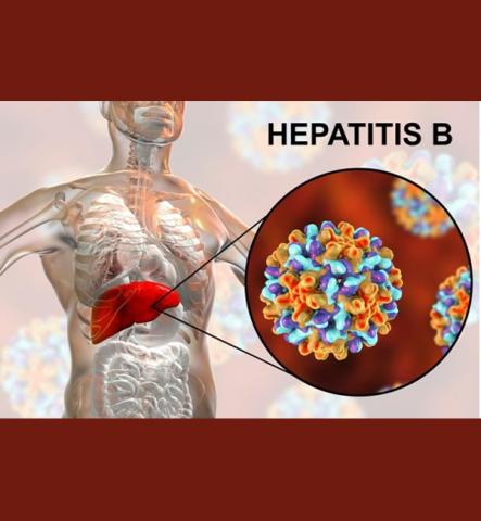 Hypertitis B